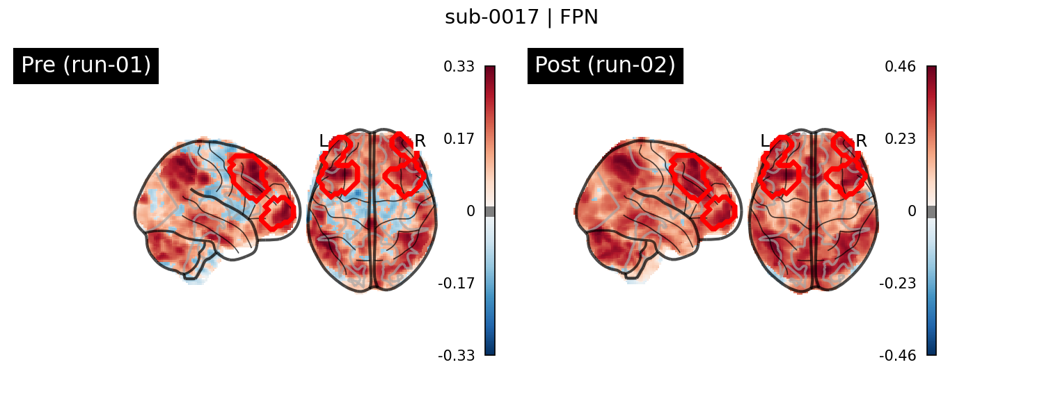 sub-0017_FPN_run-comparison.png