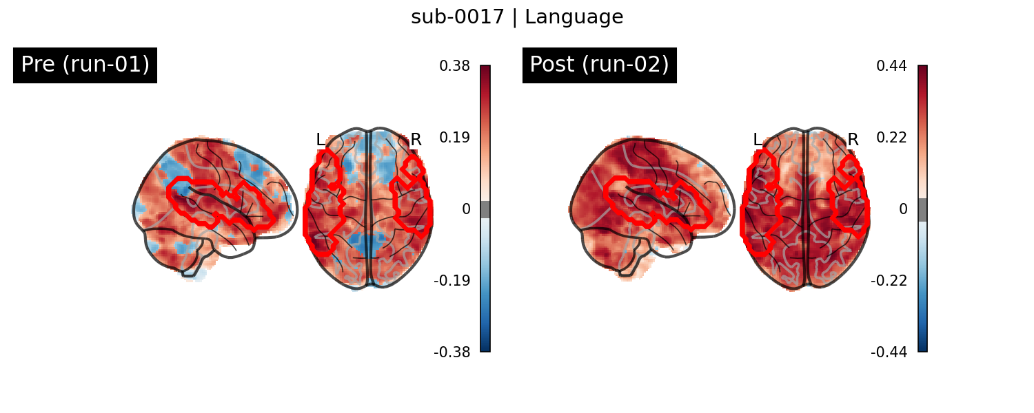 sub-0017_Language_run-comparison.png