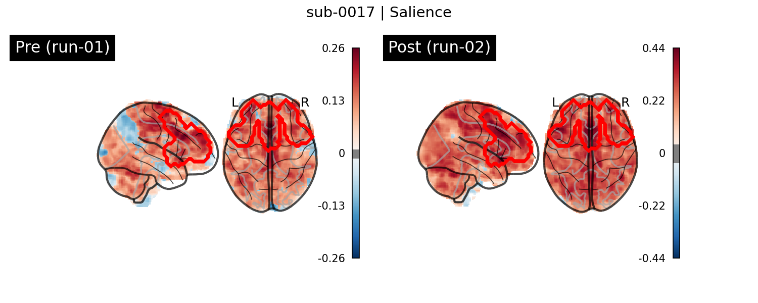 sub-0017_Salience_run-comparison.png