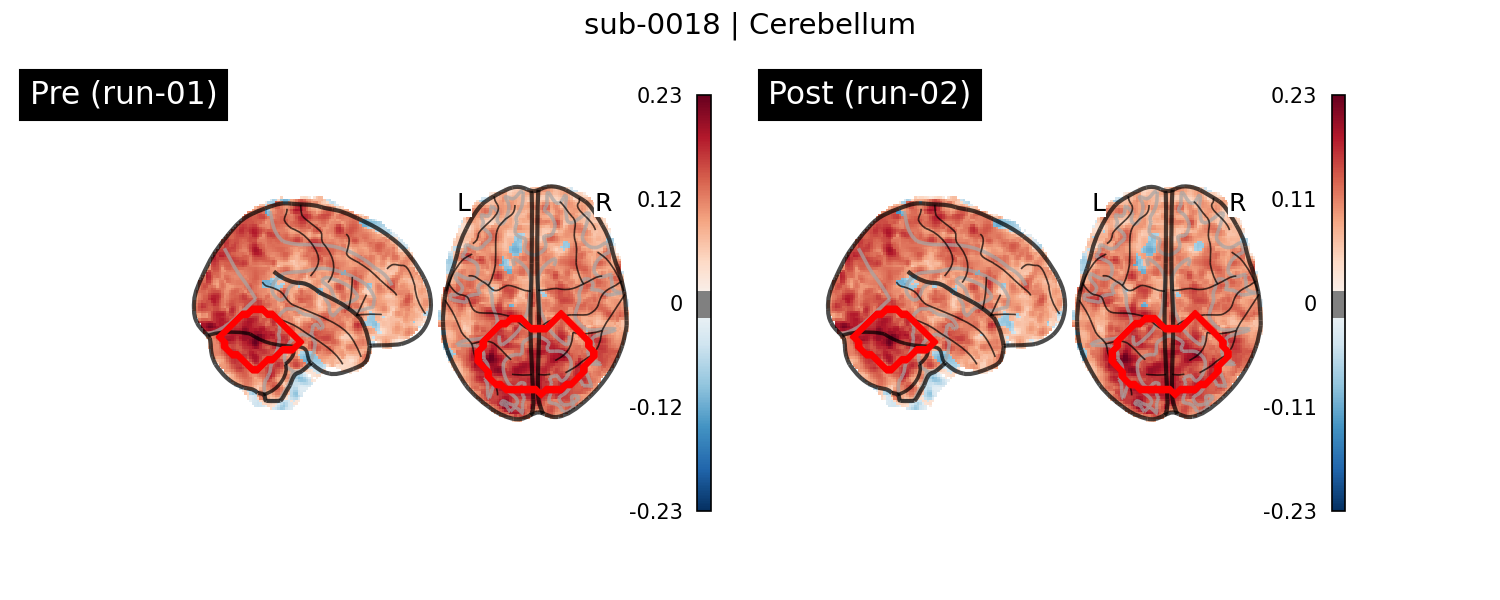 sub-0018_Cerebellum_run-comparison.png