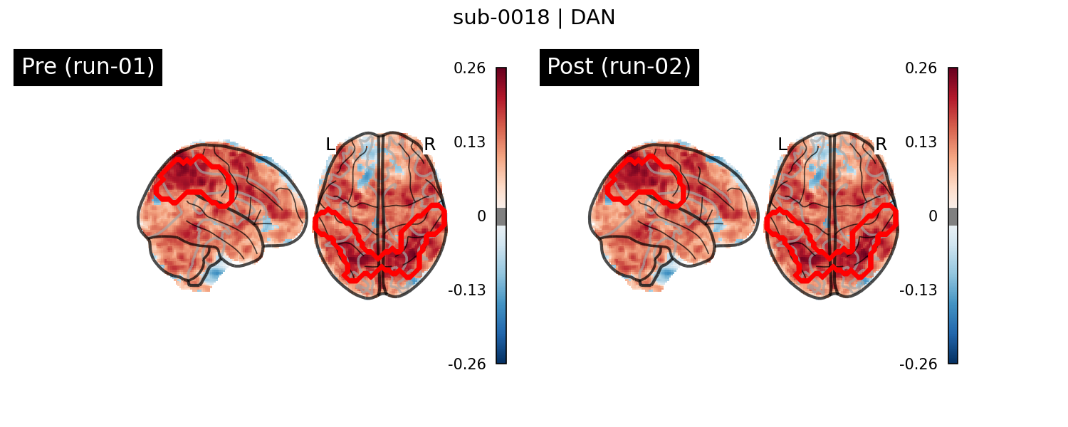 sub-0018_DAN_run-comparison.png