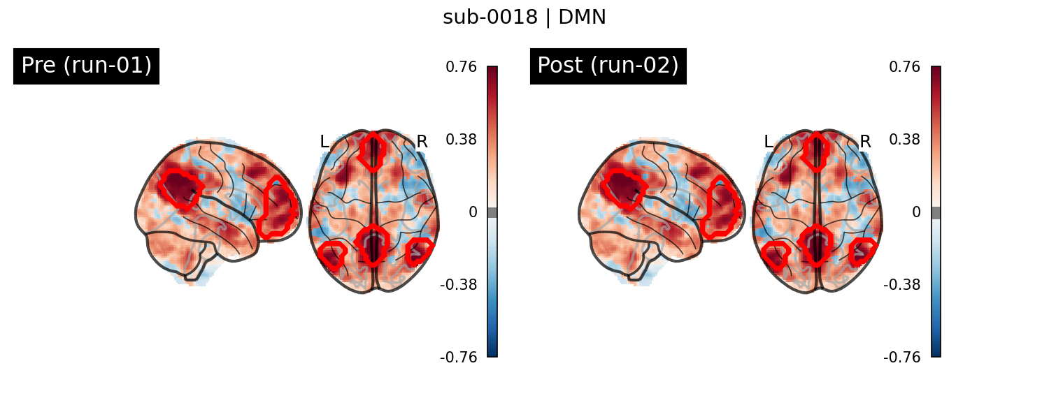 sub-0018_DMN_run-comparison.png