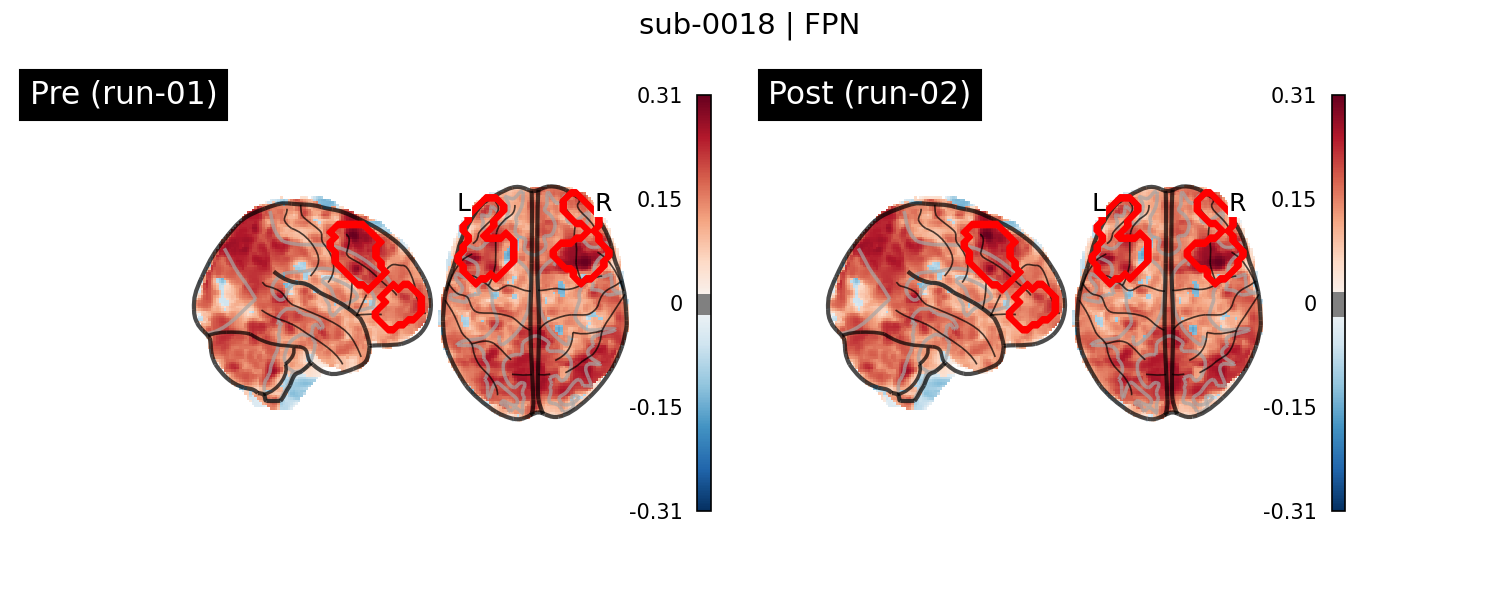 sub-0018_FPN_run-comparison.png