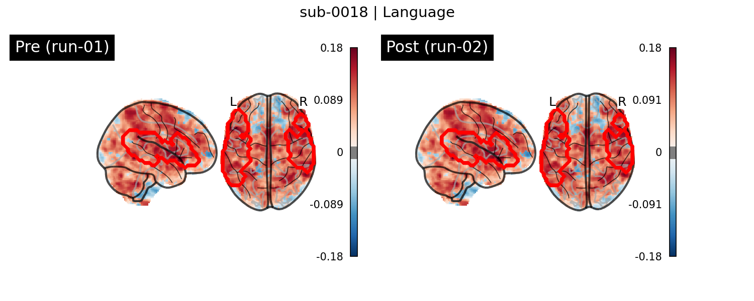 sub-0018_Language_run-comparison.png