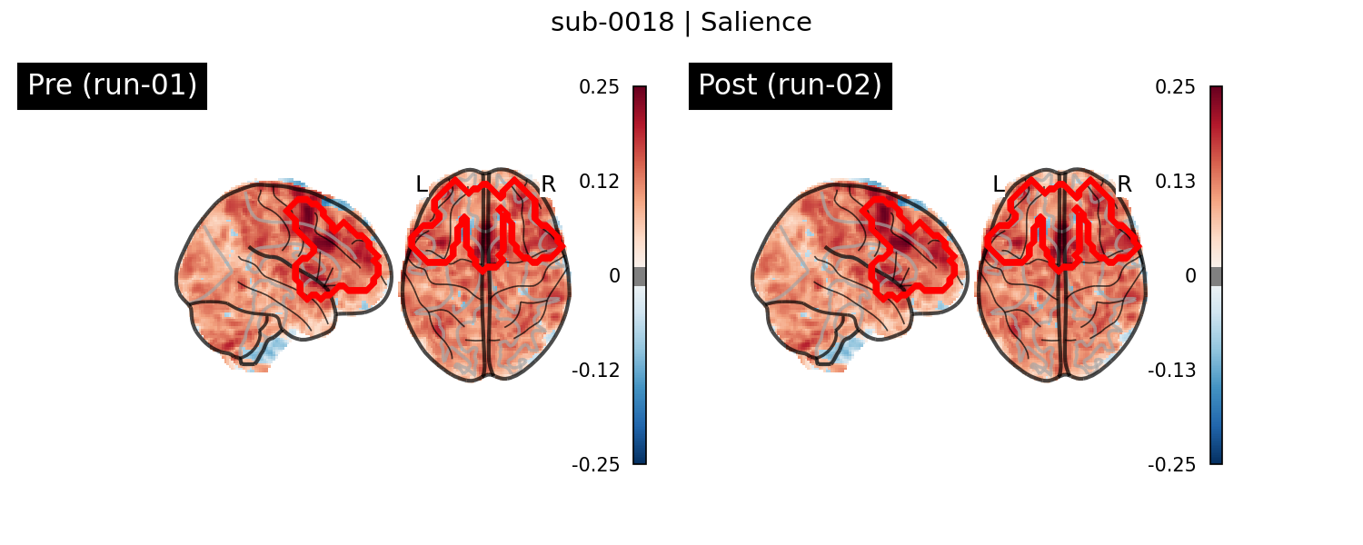 sub-0018_Salience_run-comparison.png