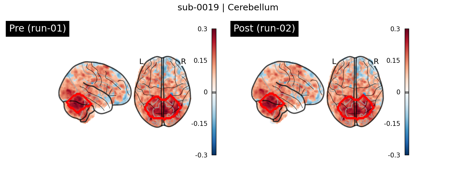 sub-0019_Cerebellum_run-comparison.png