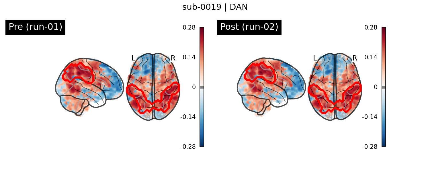 sub-0019_DAN_run-comparison.png