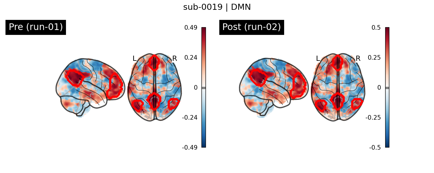 sub-0019_DMN_run-comparison.png