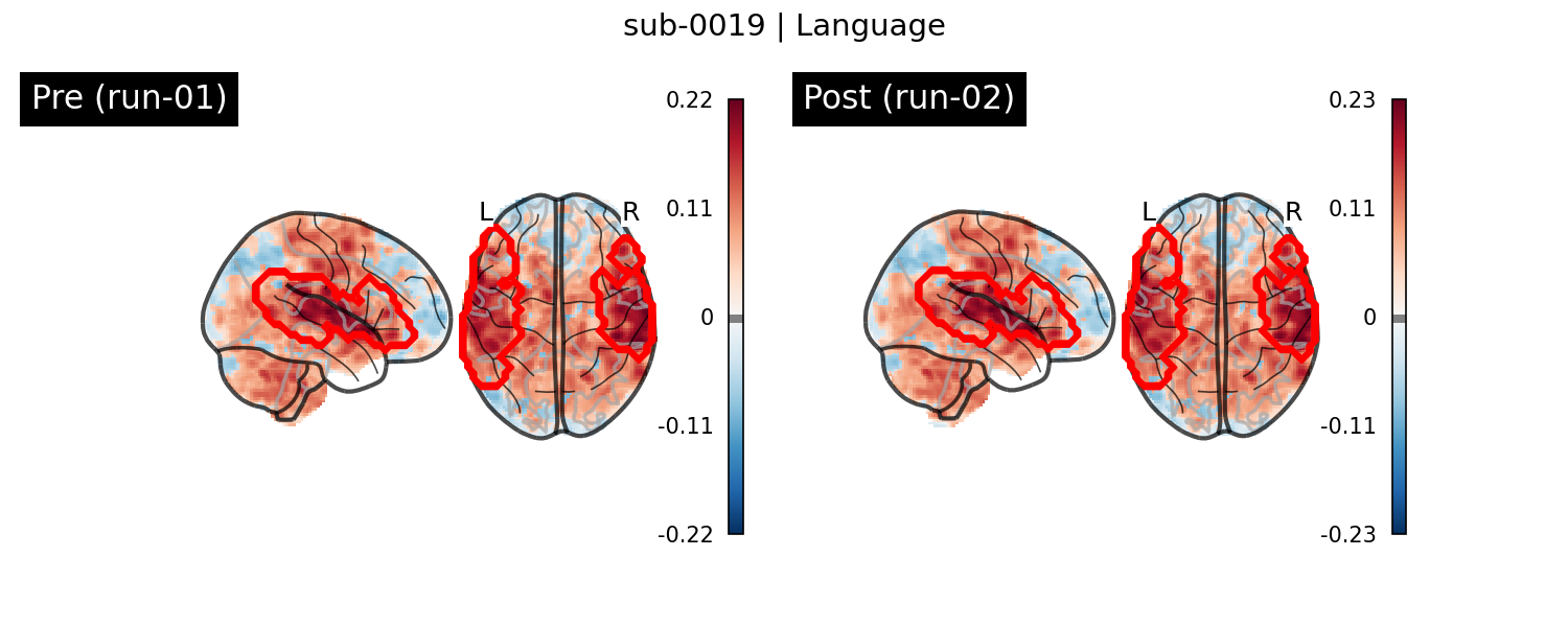 sub-0019_Language_run-comparison.png