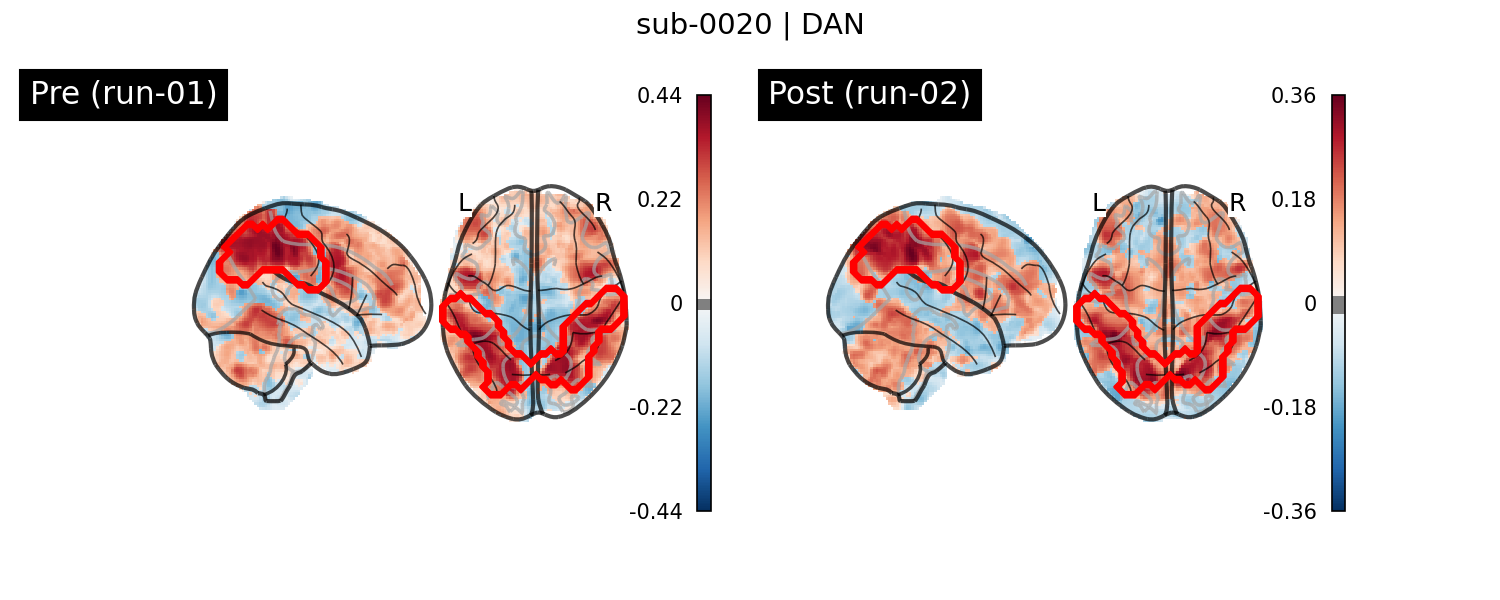 sub-0020_DAN_run-comparison.png