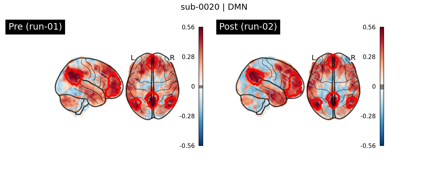 sub-0020_DMN_run-comparison.png