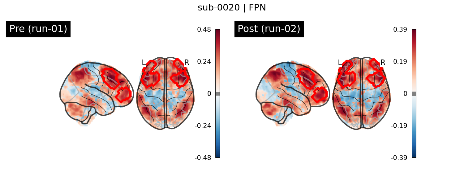 sub-0020_FPN_run-comparison.png