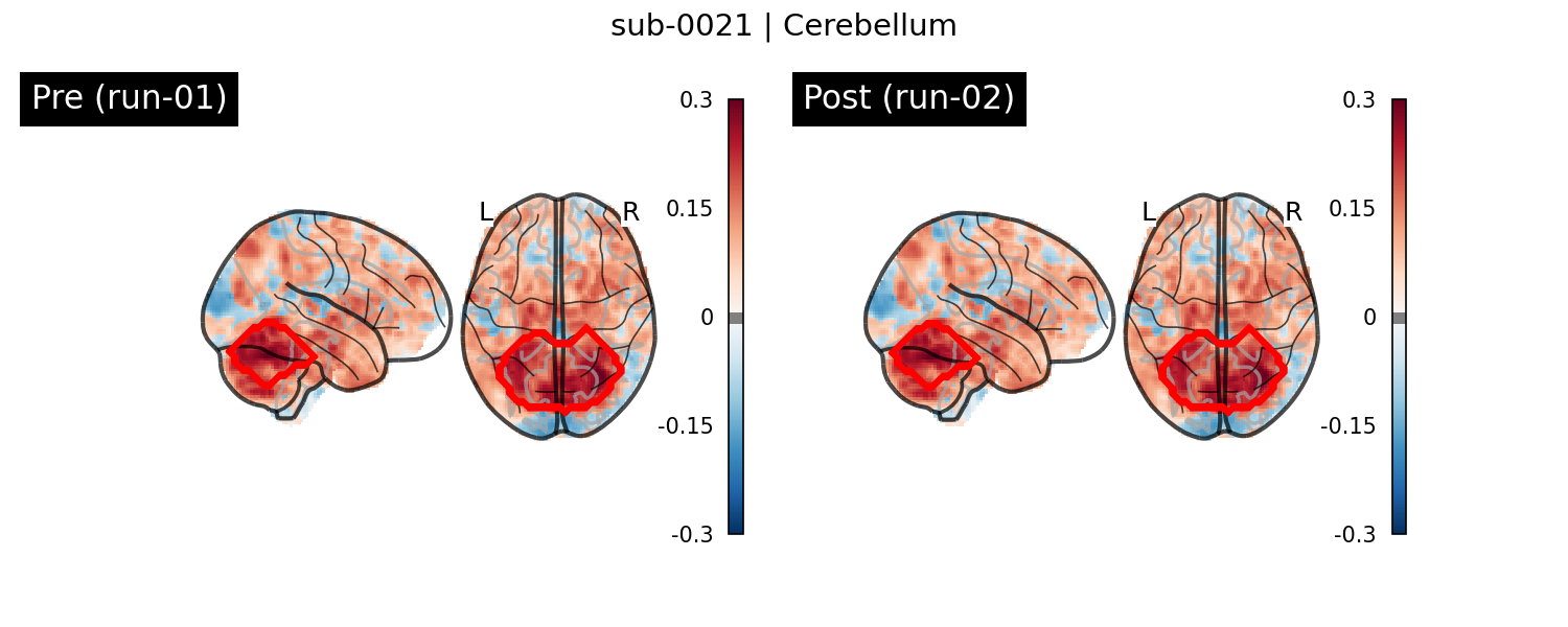 sub-0021_Cerebellum_run-comparison.png