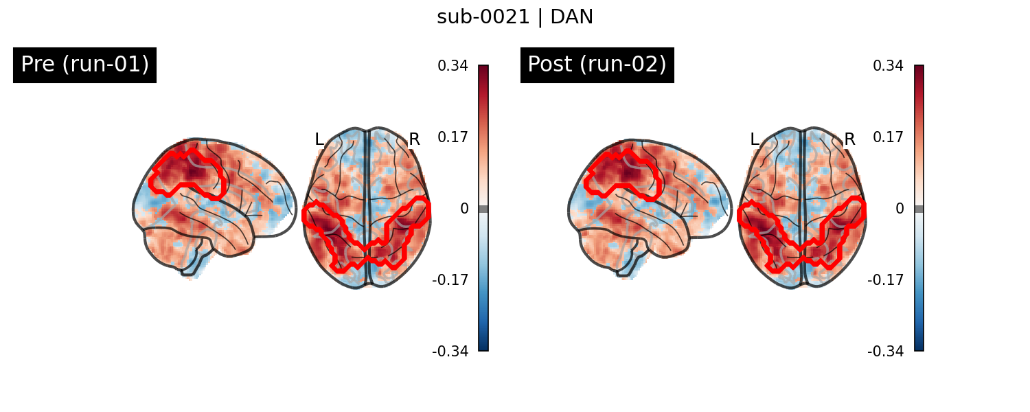 sub-0021_DAN_run-comparison.png