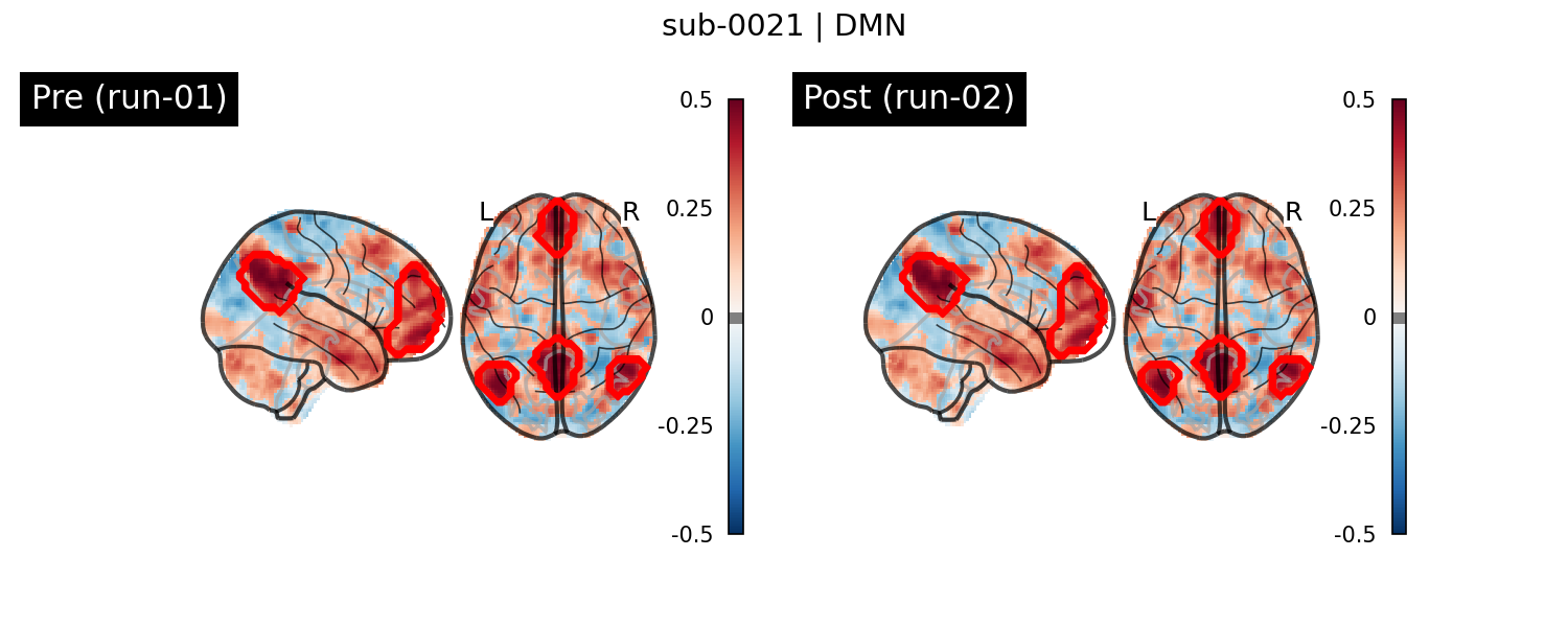 sub-0021_DMN_run-comparison.png