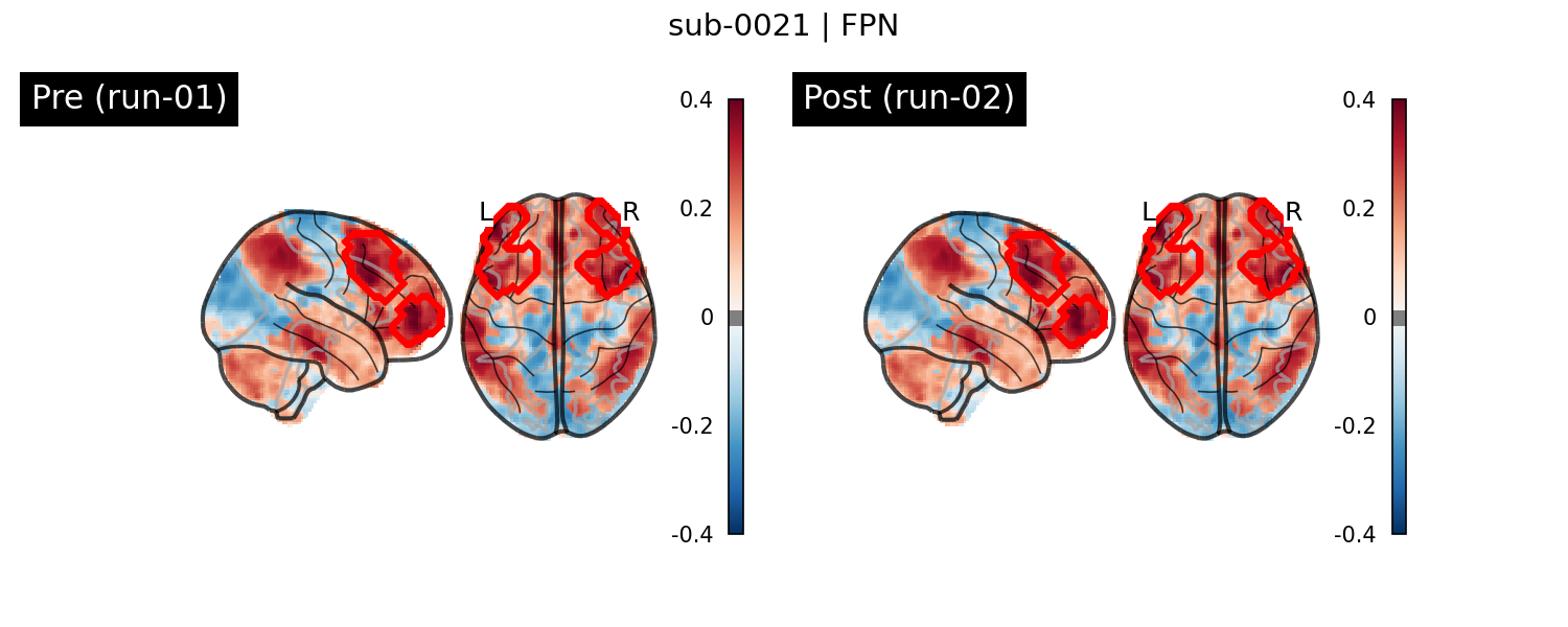 sub-0021_FPN_run-comparison.png