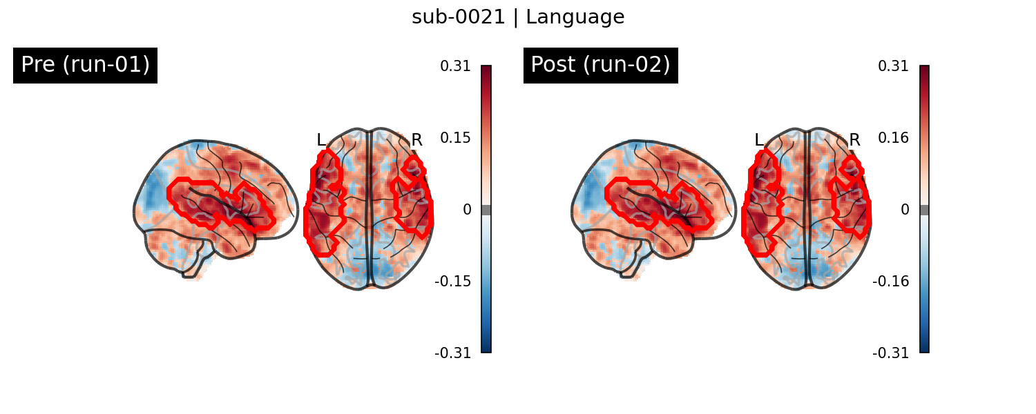 sub-0021_Language_run-comparison.png