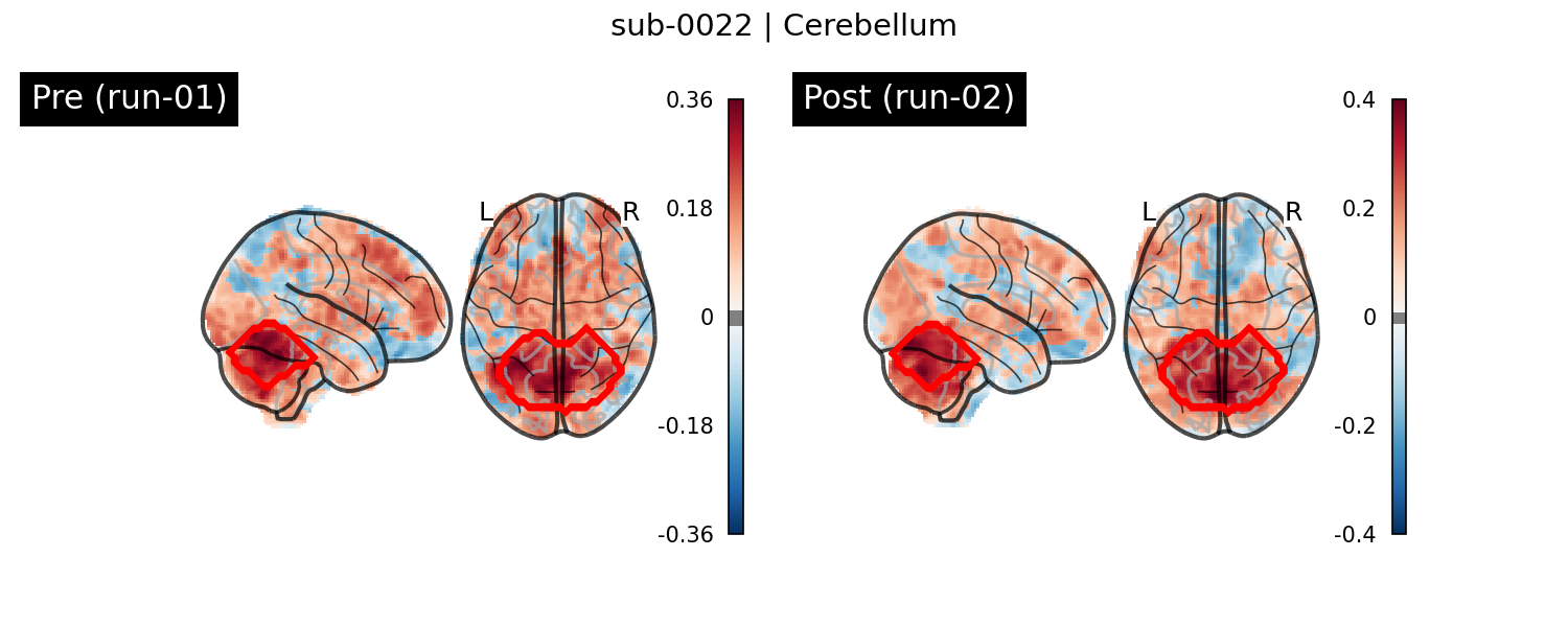 sub-0022_Cerebellum_run-comparison.png