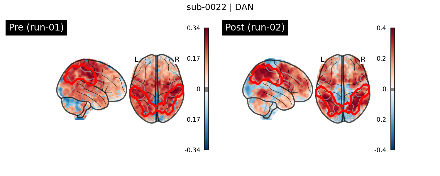 sub-0022_DAN_run-comparison.png