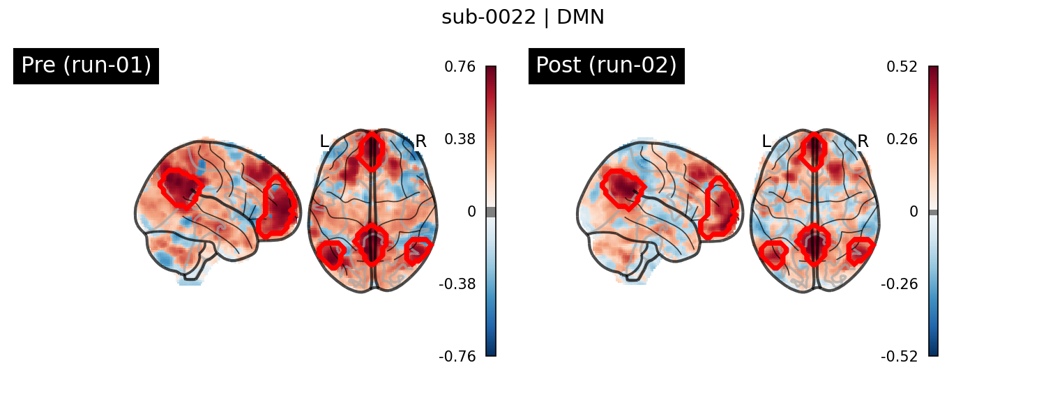 sub-0022_DMN_run-comparison.png