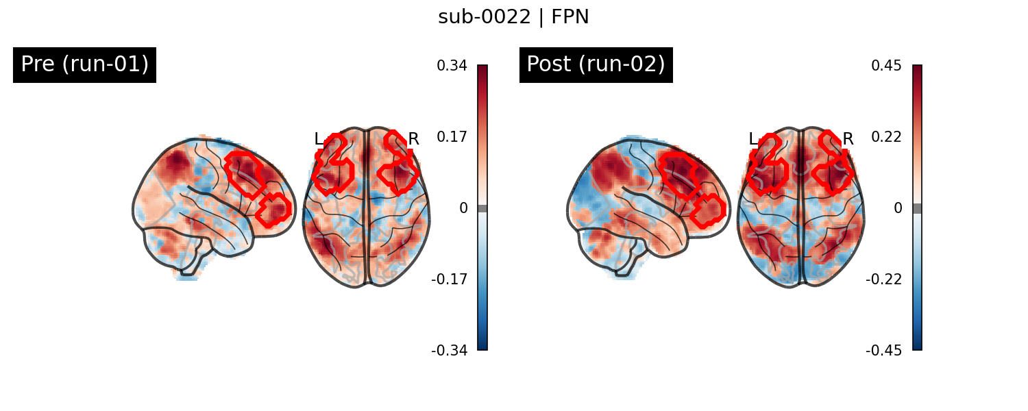 sub-0022_FPN_run-comparison.png