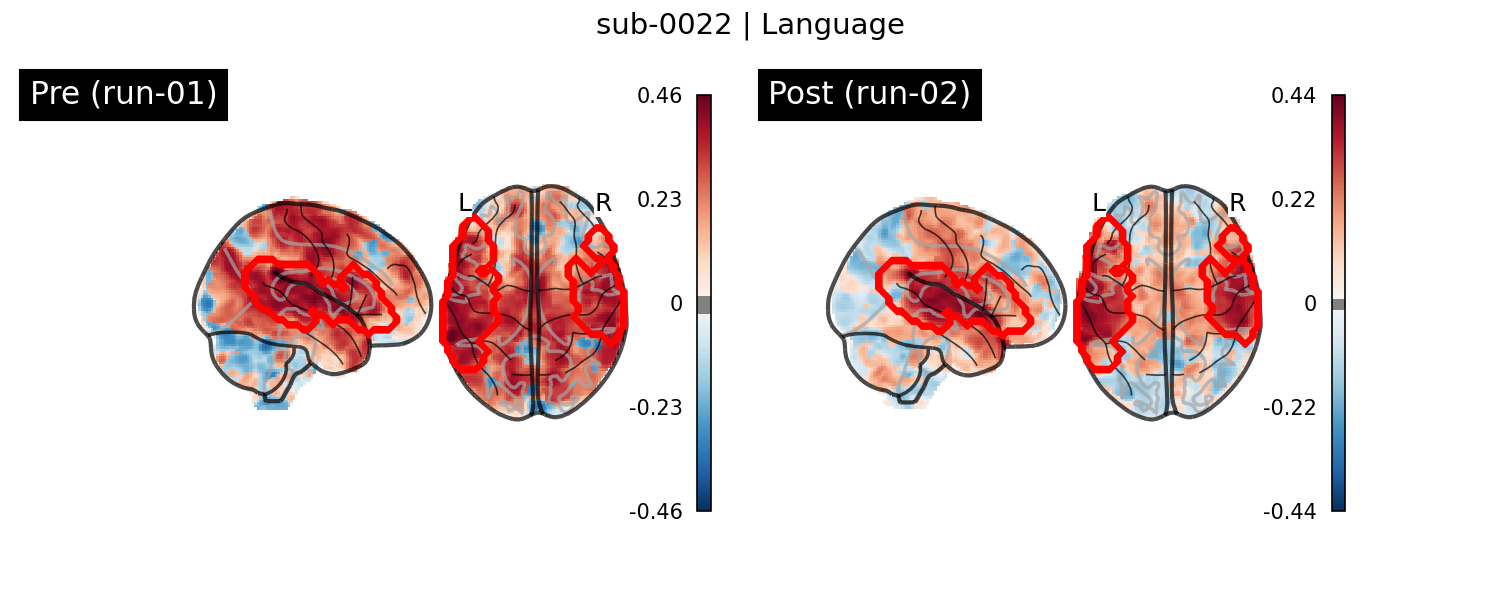 sub-0022_Language_run-comparison.png
