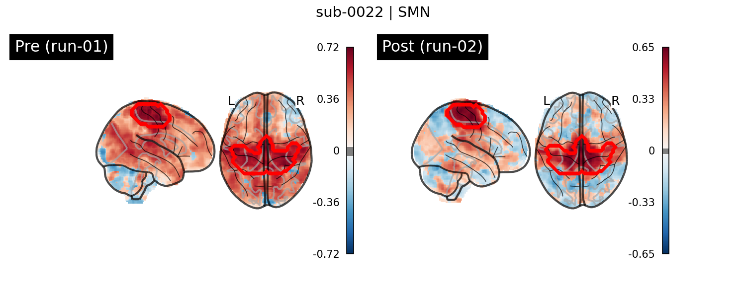 sub-0022_SMN_run-comparison.png
