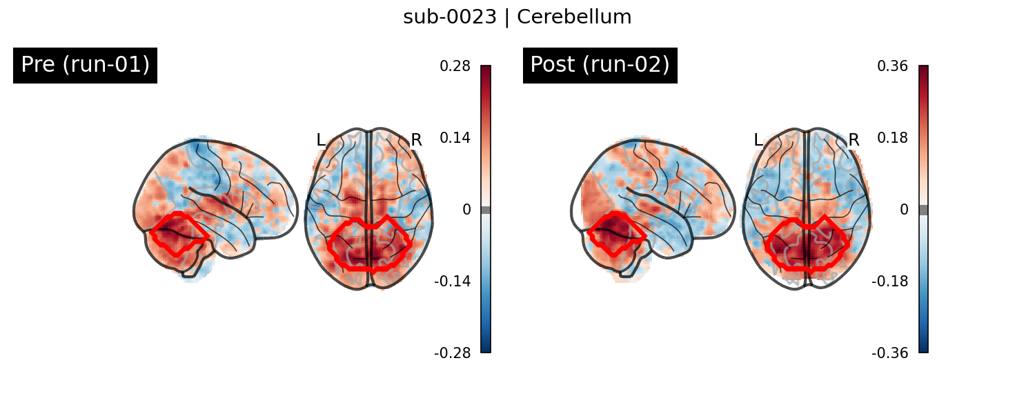 sub-0023_Cerebellum_run-comparison.png