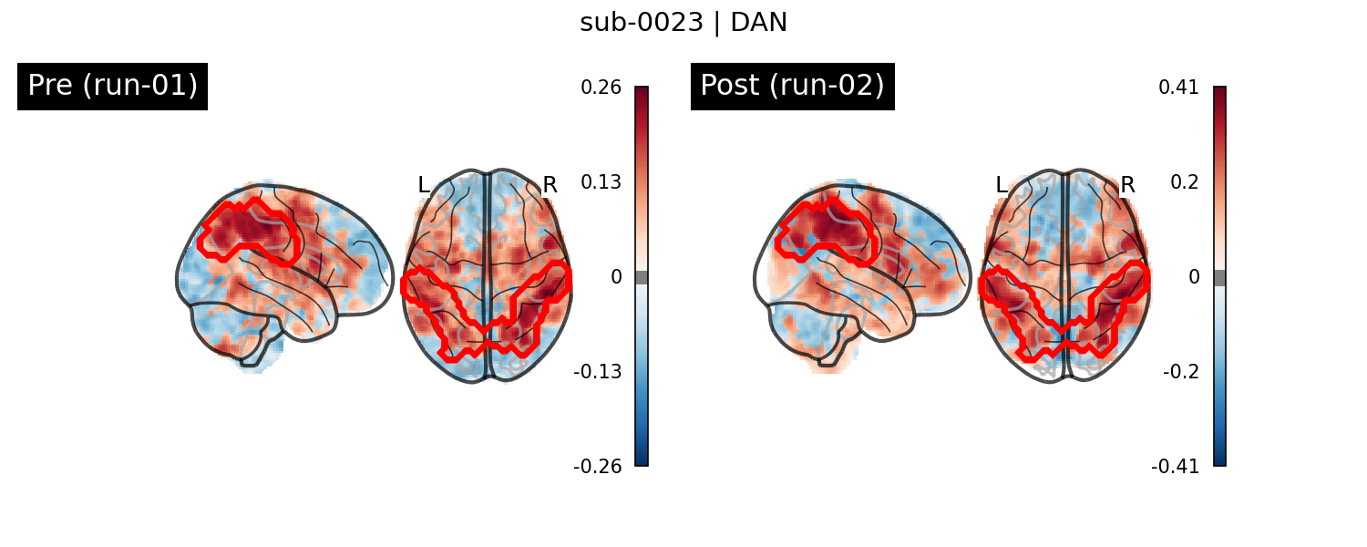 sub-0023_DAN_run-comparison.png