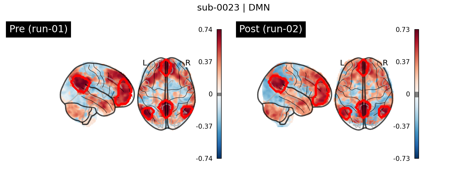 sub-0023_DMN_run-comparison.png