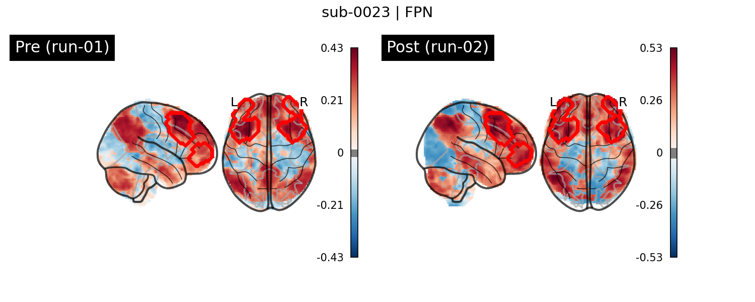 sub-0023_FPN_run-comparison.png