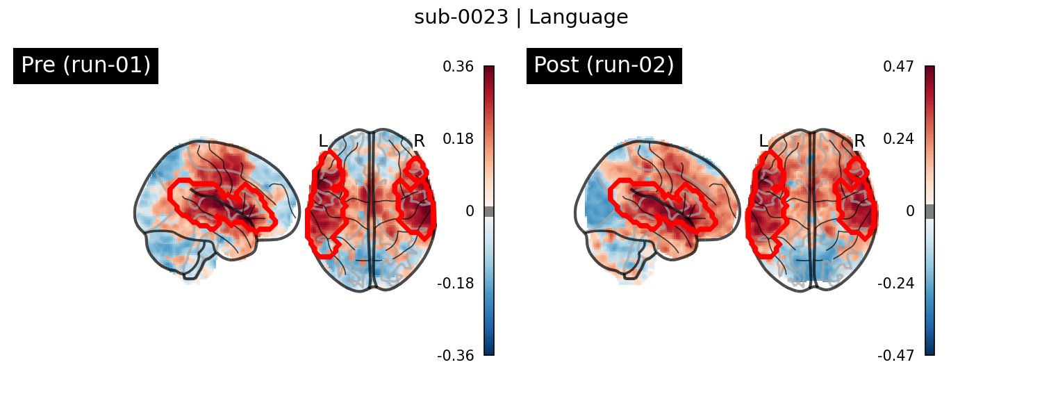 sub-0023_Language_run-comparison.png