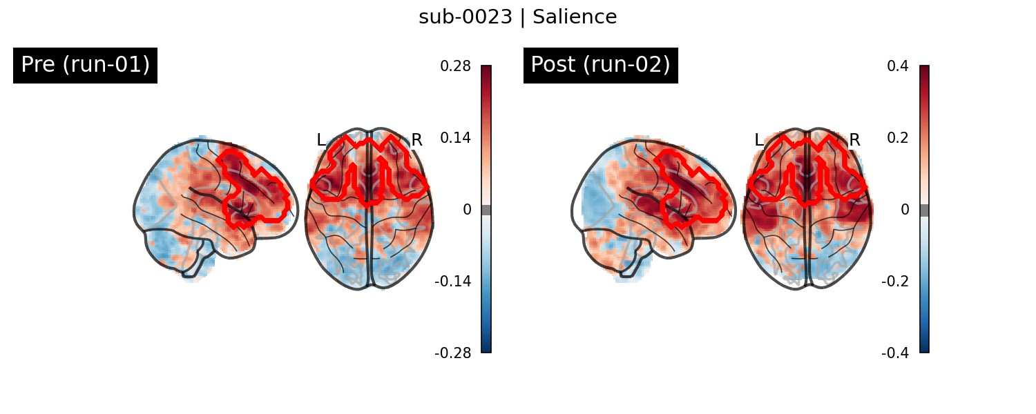 sub-0023_Salience_run-comparison.png