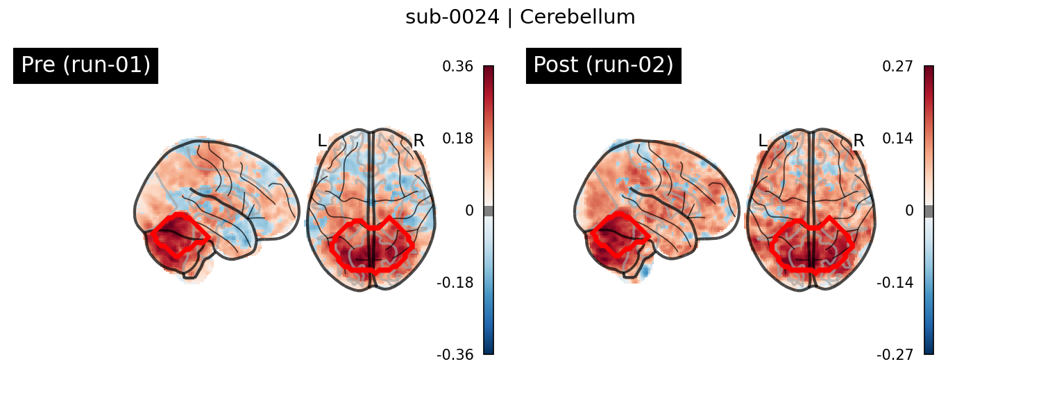 sub-0024_Cerebellum_run-comparison.png