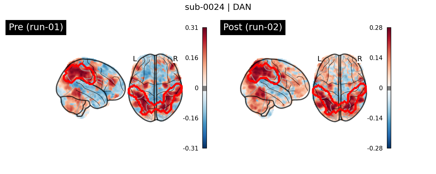 sub-0024_DAN_run-comparison.png