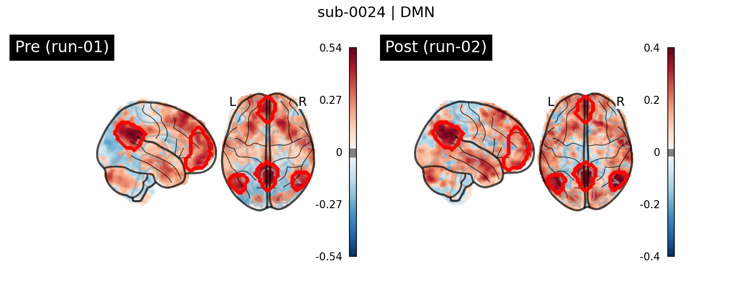 sub-0024_DMN_run-comparison.png