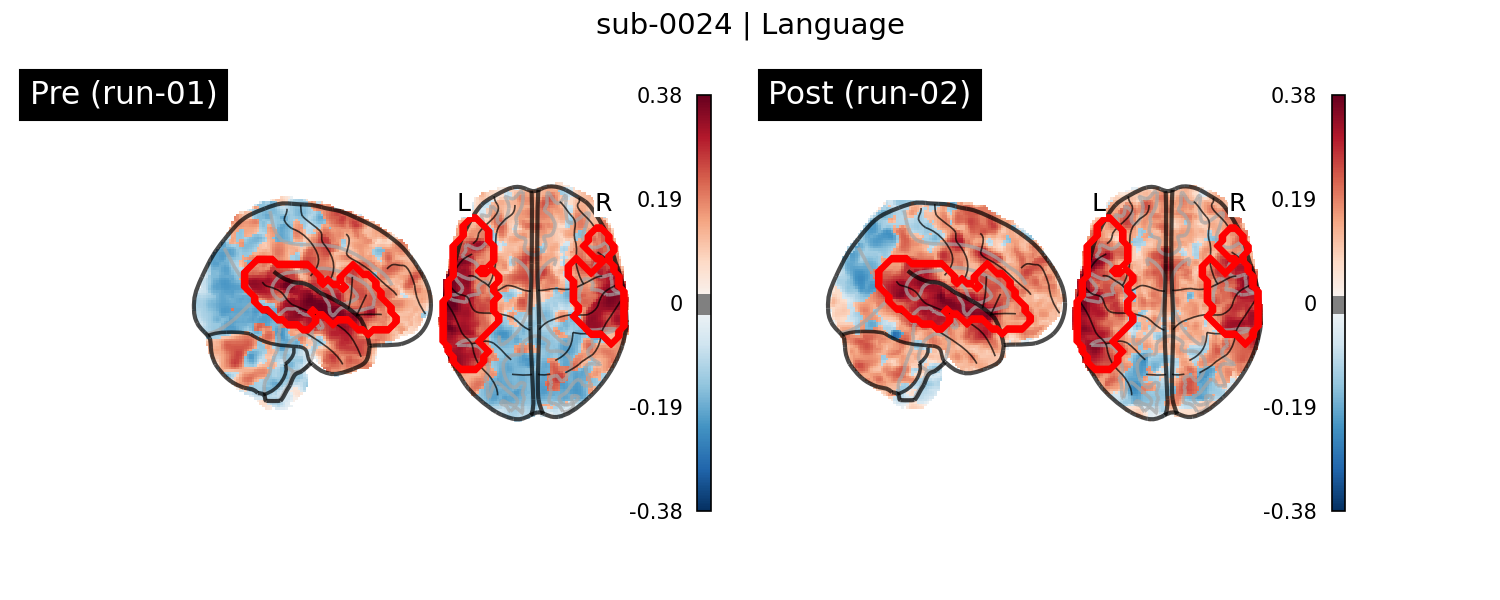 sub-0024_Language_run-comparison.png
