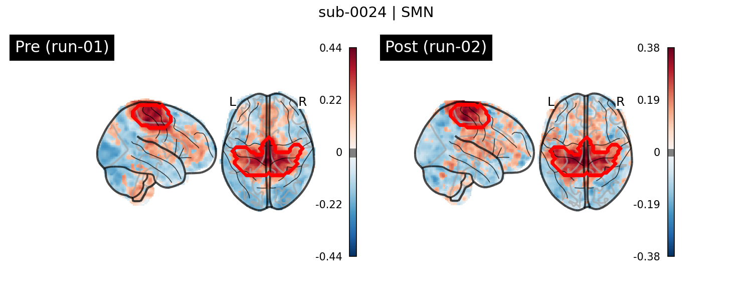 sub-0024_SMN_run-comparison.png