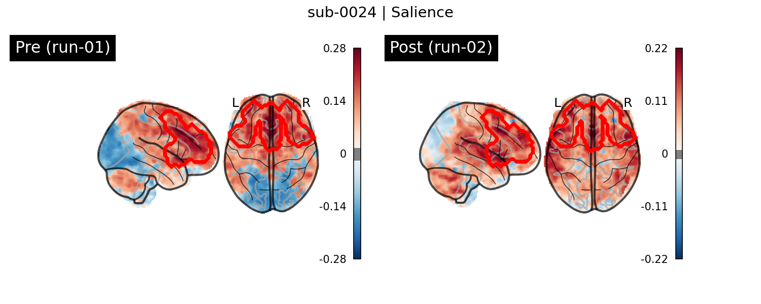 sub-0024_Salience_run-comparison.png
