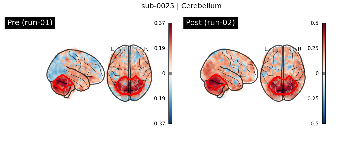 sub-0025_Cerebellum_run-comparison.png