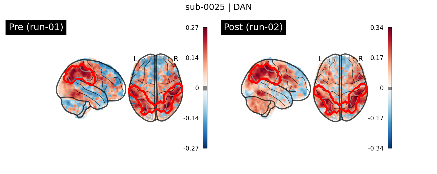 sub-0025_DAN_run-comparison.png