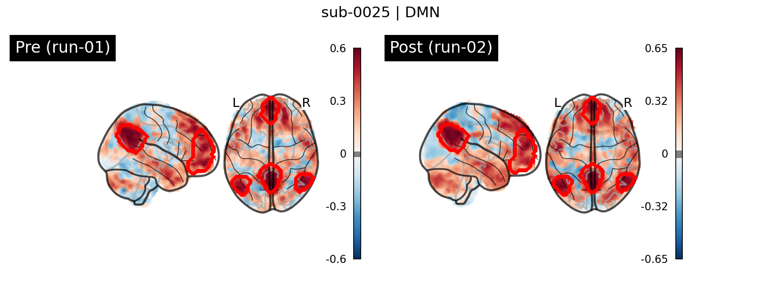 sub-0025_DMN_run-comparison.png