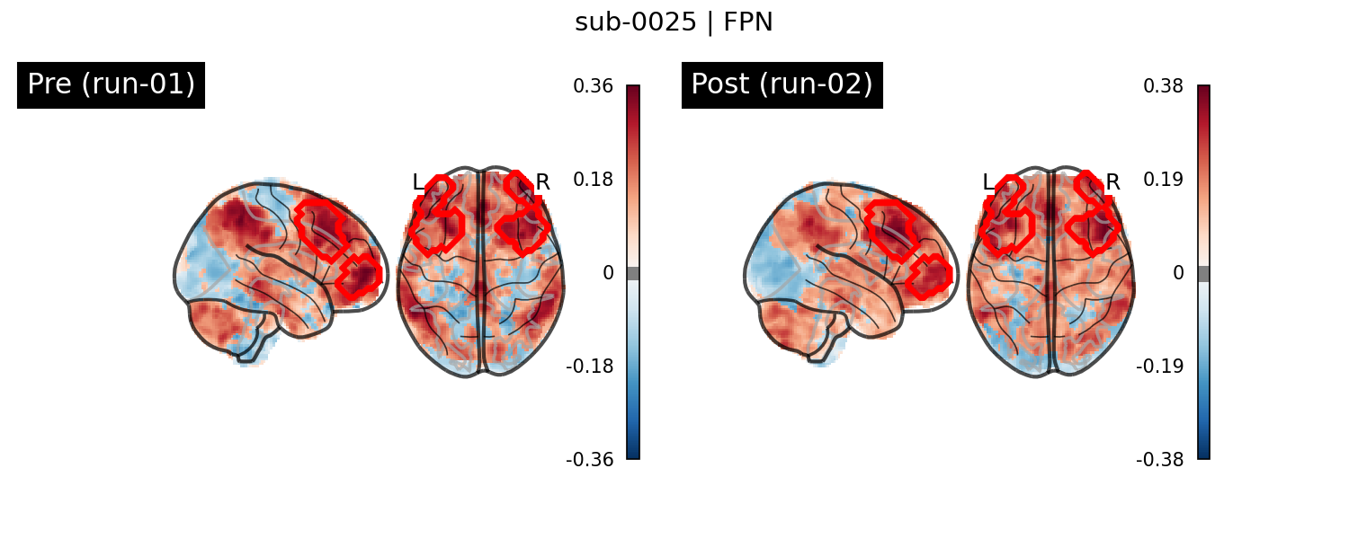 sub-0025_FPN_run-comparison.png