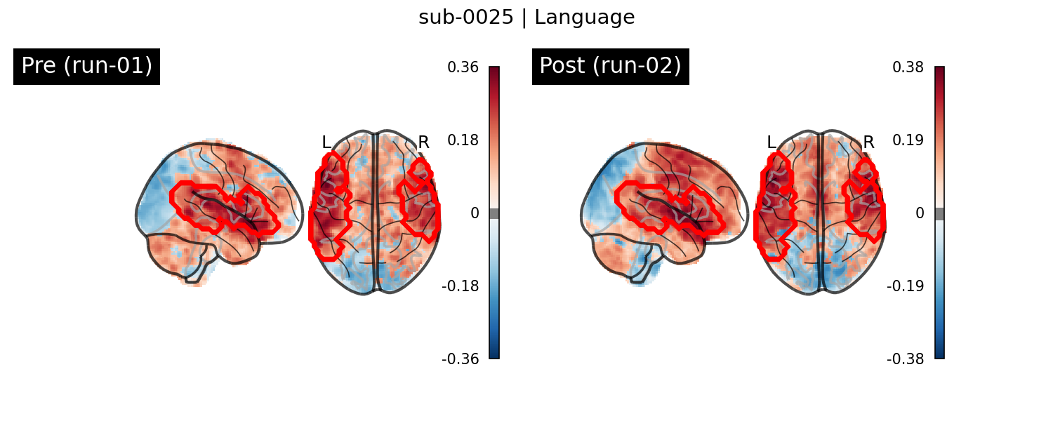 sub-0025_Language_run-comparison.png