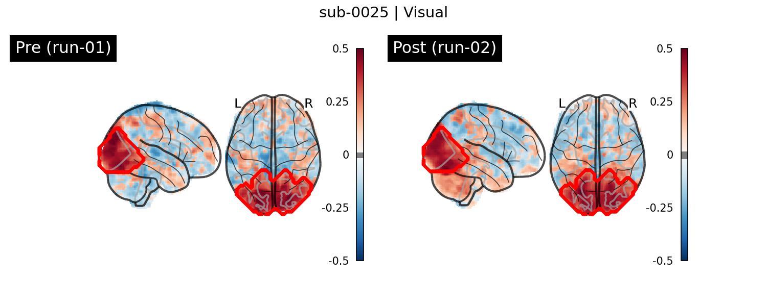 sub-0025_Visual_run-comparison.png