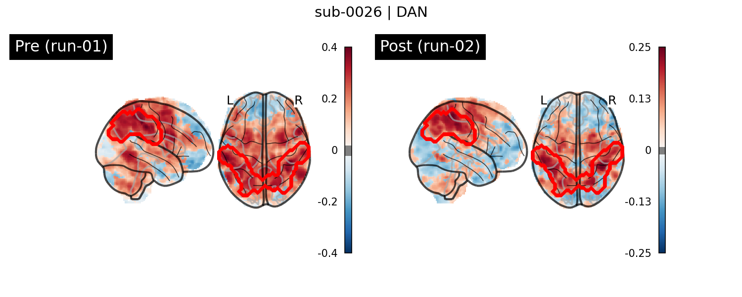 sub-0026_DAN_run-comparison.png