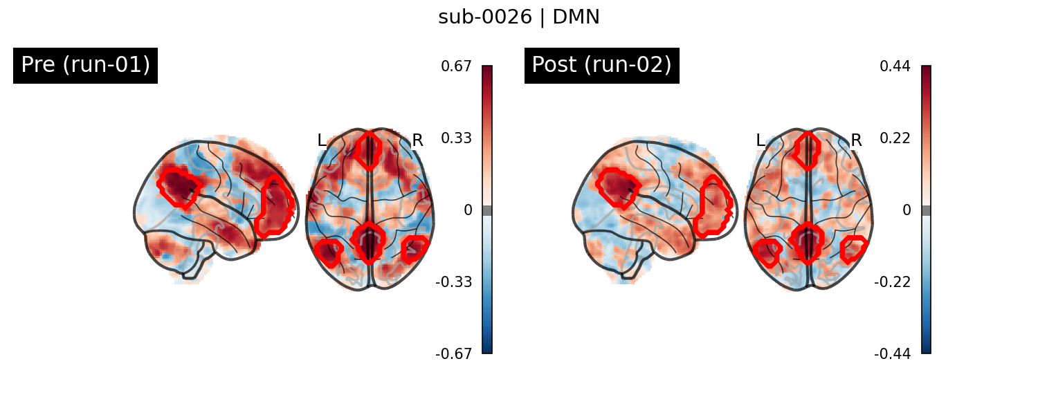 sub-0026_DMN_run-comparison.png