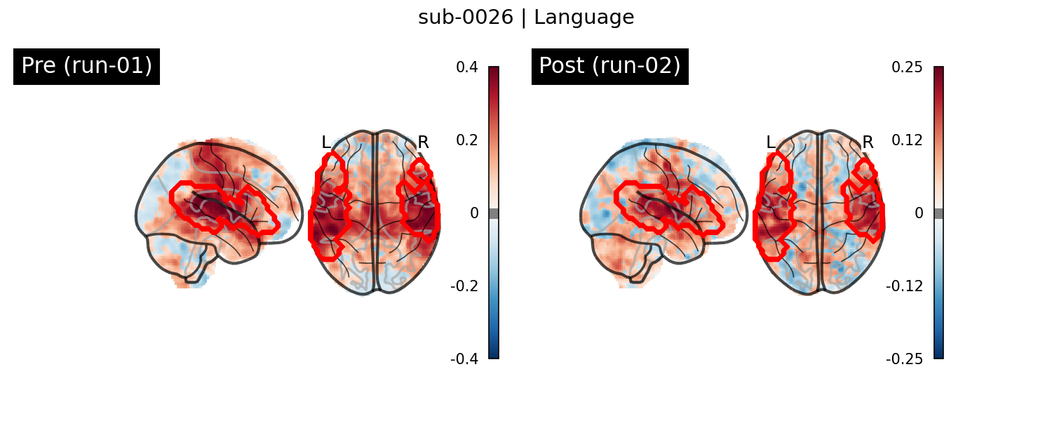 sub-0026_Language_run-comparison.png