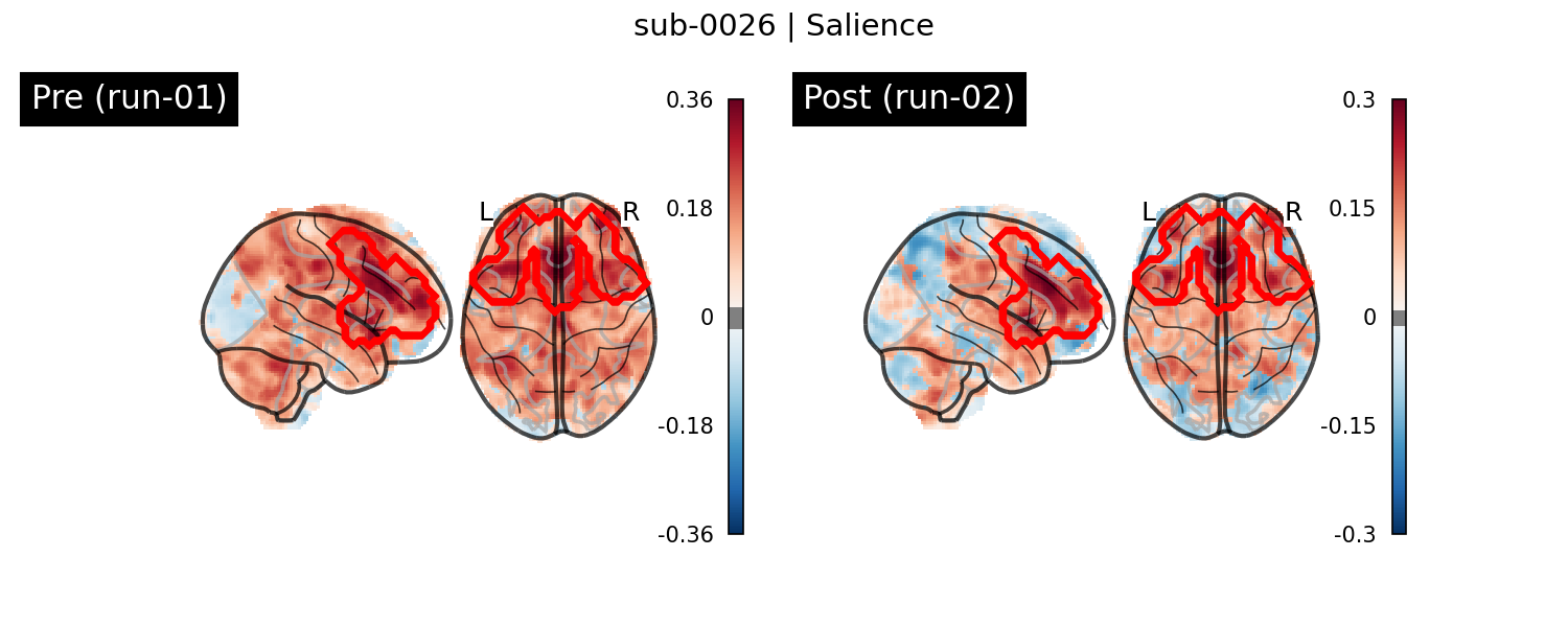 sub-0026_Salience_run-comparison.png