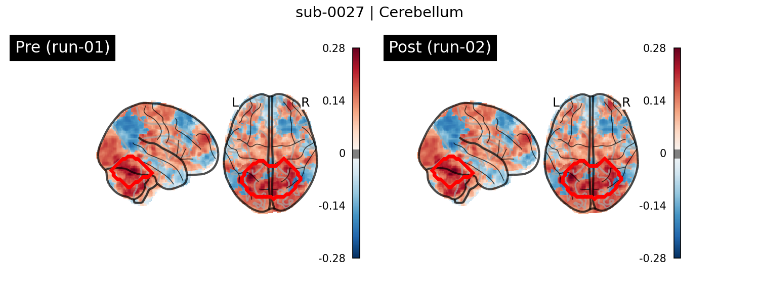 sub-0027_Cerebellum_run-comparison.png